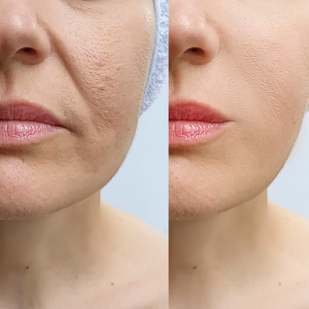 Vegan Niacinamide Brightening Day Skin Care Serum