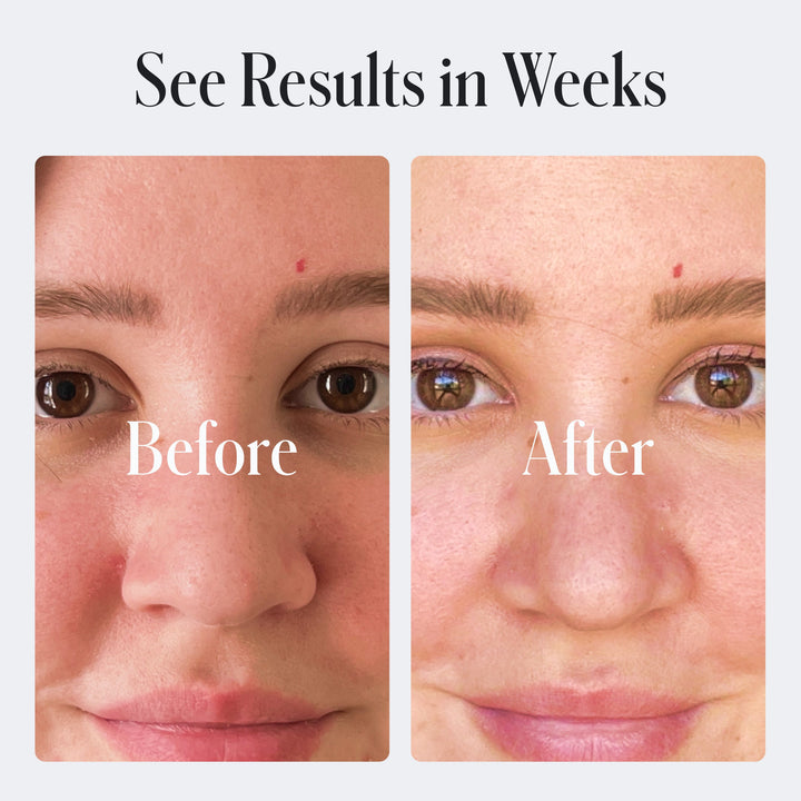 Non-Toxic Retinol &amp; Niacinamide Nighttime Skin Care